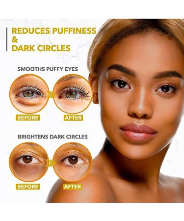 24k Gold Under Eye Mask for Dark Circles, Puffiness & Wrinkles - Collagen Eye Patches for Puffy Eyes - Skincare Treatment for Women & Men - 30 Pair - Buy Online on SooperMarket.com