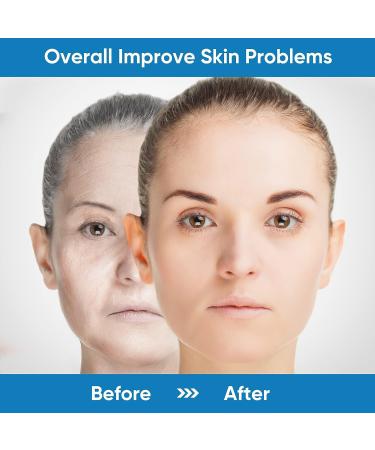 Microcurrent Face & Neck Massager for Wrinkle Reduction and Skin Tightening - Intelligent Facial Device for Contoured Beauty - Blue - Buy Online on SooperMarket.com