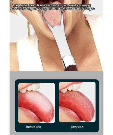 Stainless Steel Tongue Scraper - Oueyfer Tongue Cleaning Tool for Fresh Breath & Oral Hygiene - Buy Online on SooperMarket.com