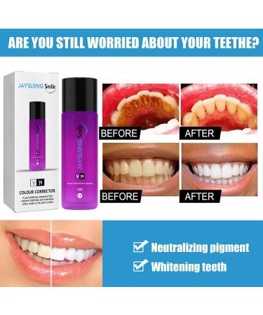 Teeth Whitening Serum - Brighten, Reduce Yellowing, and Cleanse Gums - Buy Online on SooperMarket.com