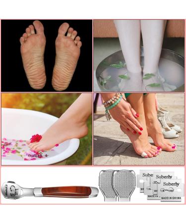 YIMART Foot Corn Removal Cutter Scraper Set - Stainless Steel Callus Remover with 10 Blades - Professional Pedicure Tool for Dead Skin and Cuticles - Buy Online on SooperMarket.com