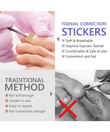 Toen il Correction Sticker 100Pcs: N il Repair P tches Restores Appearance of Discolored or Damaged Nails Foot Care - Buy Online on SooperMarket.com