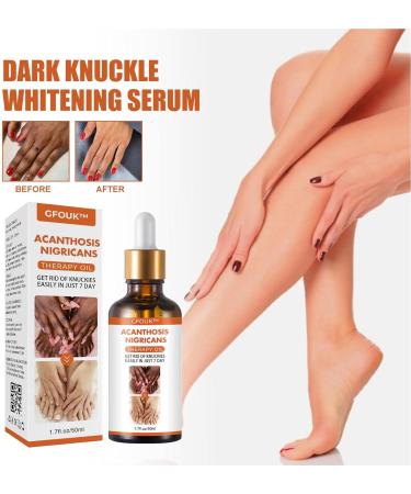 Skin Bleaching Serums | Dark Skin Permanent Whitening Lightening | Armpit Bleaching Serums for Women Supercharged Face Serums Skin Lightening Bleaching Oil Black Spot Corrector Remover for Face 2Pcs - Buy Online on SooperMarket.com