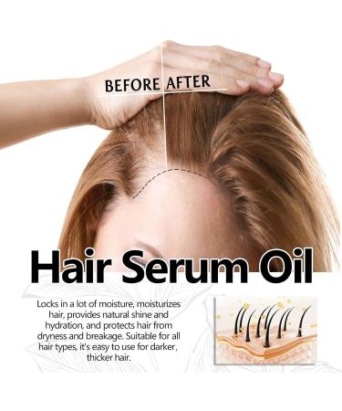 Neviux Natural Hair Growth Oil Hair Growth Serum Rosemary Hair Oil Nourishing Damaged Hair Oil for Drying Damaged Hair and Hair Care Prevent Hair Loss - Buy Online on SooperMarket.com