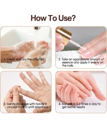 Organic Cuticle Nail Oil 30ml Vitamin B & E Essential Oil Moisturize with Convinient Dropper Design Nail Cuticles Oils Treatment Damaged Dry for Nail Care Repair Growth (Herbal) - Buy Online on SooperMarket.com