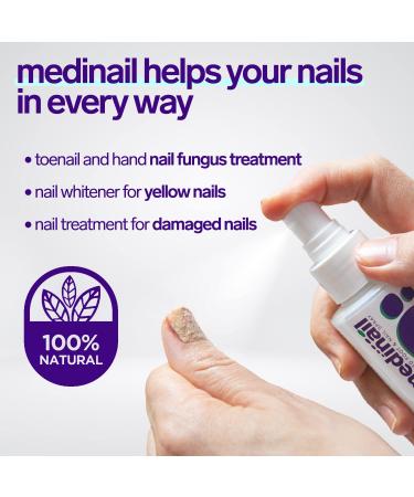 Medinail Fungus Spray - Advanced Nail Fungus Treatment and Strengthener 3.38 Fl Oz - Buy Online on SooperMarket.com