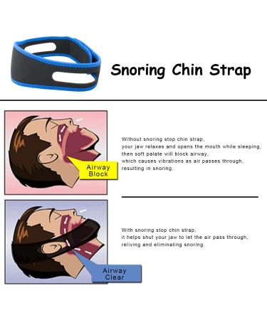 2023 Newest Anti Snoring Chin Strap - Effective Stop Snoring Aid for Men and Women - Adjustable & Breathable - Buy Online on SooperMarket.com
