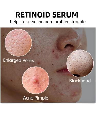 Face Moisturiser Retinoid 2% Emulsion Retinol Serum High Strength for Face Retinol Face Serum Anti Wrinkle Serum Fade Fine Lines Acne Reduced Skin Repair Serum for Women & Men 30ml 1PC Retinoid 2% Emulsion - Buy Online on SooperMarket.com