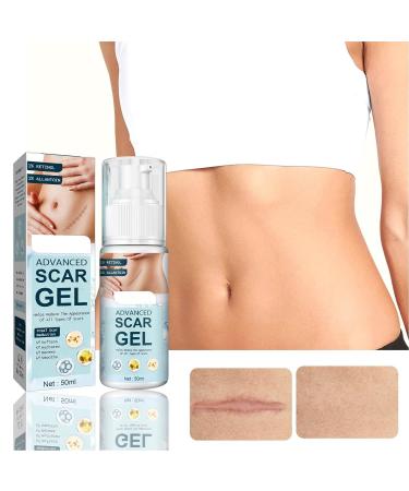 Stretch Marks & Scar Gel 50ml - Safe Vitamin E Formula for Effective Removal - Buy Online on SooperMarket.com