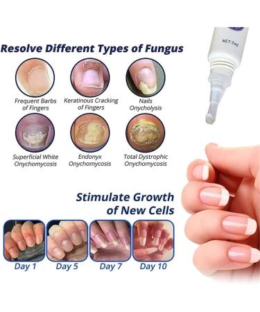 7 Days Nail Recovery & Growth Essence Pen - Strengthening Serum for Thin Nails (2PCs) - Buy Online on SooperMarket.com