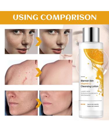 Vitamin C Face Cleanser for Oily Skin Hydrating Cleanser for Large Pore Vitamin C Skin Cleanser for Face Smooth Skin Tone & Control Skin Oil Gentle Face Cleanser For All Skin Type Dense Foam-Hydrating - Buy Online on SooperMarket.com