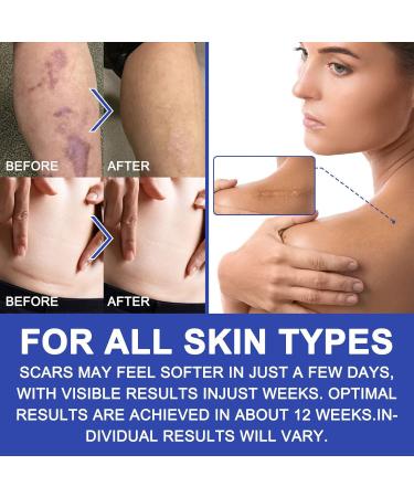 Silicone Scar Sheets 1.6x120 - Scar Removal Tape for Burn, Acne, C-Section & Surgery - Reusable & Washable - Buy Online on SooperMarket.com