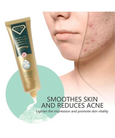 Silicone Scar Ointment 30g - Moisturizing Scar Cream for Smooth, Inconspicuous Scar Removal - Buy Online on SooperMarket.com