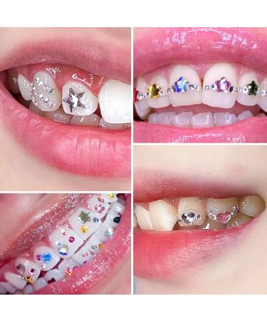 Buy NIKTULE DIY Crystal Tooth Sets - Complete Disch-Edelstein Collection for Men & Women | International Shipping Available - Buy Online on SooperMarket.com