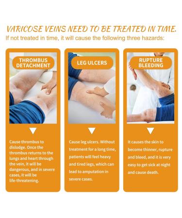 Vitamin K Cream for Varicose Veins - Miracle Cream for Spider Veins & Leg Vein Removal (1pcs) - Fast International Shipping - Buy Online on SooperMarket.com