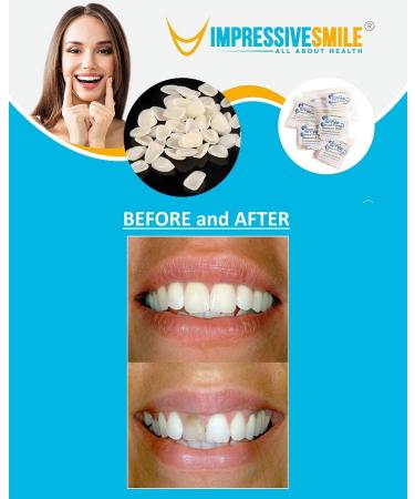 Ultra Thin Tooth Whitening Veneers for Missing or Broken Teeth | Realistic Cosmetically Enhanced Smile | Shade A-2 - Buy Online on SooperMarket.com