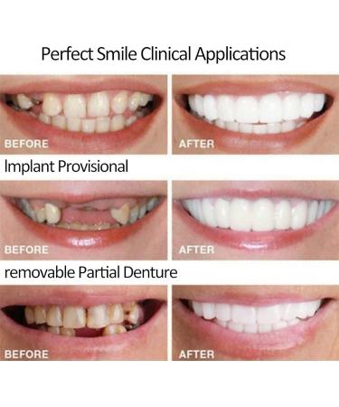 2 Pairs Dentures - Elastic and Comfortable Fake Teeth for Missing Teeth - Buy Online on SooperMarket.com