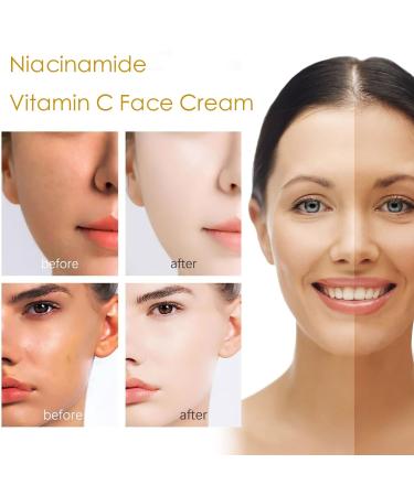 Nicotinamide & Vitamin C Face Cream - Hydrating Moisturizer & Makeup Cream (2 Pcs) - Brightening Smooth Skin Formula - International Shipping Available - Buy Online on SooperMarket.com