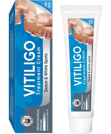 UpdateClassic Vitiligo Cream, Natural Vitiligo Treatment for Skin Vitiligo, Vitiligo Care Cream, Reduce White Spots and Improve Skin Pigmentation, Easy to Use, Blue/Vitiligo