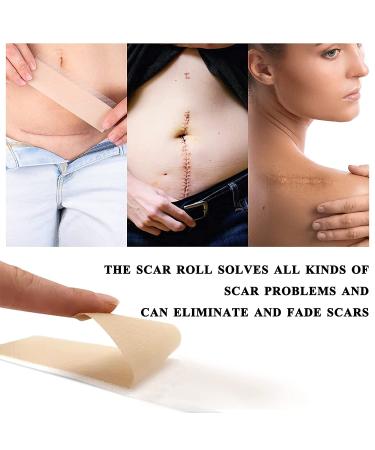 Medical Grade Silicone Scar Tape Roll (1.6 x 60) for Scar Removal - Professional Silicone Strips for Surgery, C-Section, Acne, Burn and Keloid - Safe & Reusable - 1.5M - Buy Online on SooperMarket.com