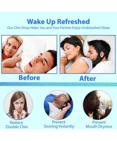 Chin Straps for Snoring - Effective Anti Snoring Devices - Adjustable Anti Snoring Devices - Soft and Breathable Anti-Snoring Chin Strap for Men and Women to Stop Snoring - Buy Online on SooperMarket.com