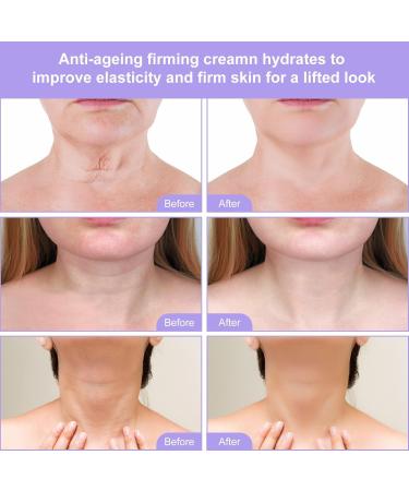 Neck Firming Cream - Skin Tightening & Anti-Wrinkle Solution for Face & Body | Reduce Sagging Skin & Double Chin - Buy Online on SooperMarket.com