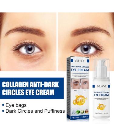 Jasmine Ointment for Dark Circles & Wrinkles - 2PCs Kaluofan Eye Cream with Collagen & Aloe Vera - Buy Online on SooperMarket.com