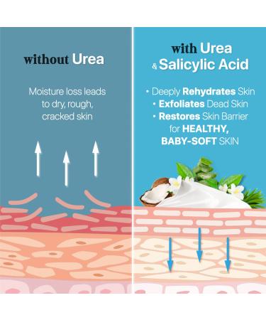Urea Cream 40 with Salicylic Acid 4.6 Oz - Intensive Callus Remover for Dry Cracked Feet & Hands - Moisturizing & Exfoliating Foot Cream - 4.6 Ounce (Pack of 1) - Buy Online on SooperMarket.com