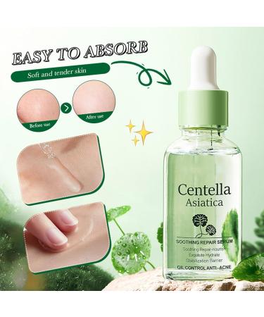 Centella Asiatica Soothing Repair Facial Serum | Lightweight Hydrating Daily Moisturizer | Anti-Acne & Oil Control | 30ml - International Shipping - Buy Online on SooperMarket.com