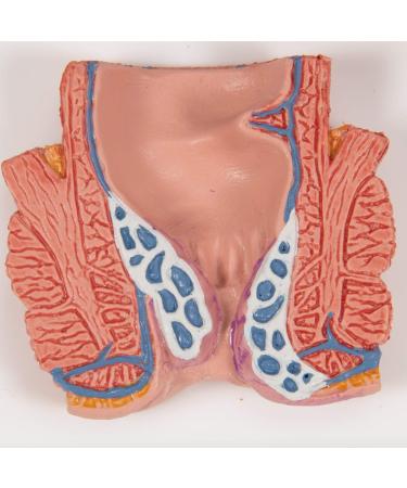 3B Scientific K27 Hemorrhoid Model 5.5-Inchx3.9-Inchx5.5-Inch - Buy Online on SooperMarket.com