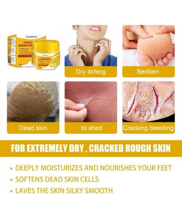 Anti-Dry Skin Foot Cream | Nourishing Moisturizer for Dry Feet - A Size | International Shipping Available - Buy Online on SooperMarket.com
