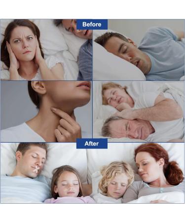 Sleep Strips 120 Pcs - Gentle Mouth Tape for Nose Breathing | Stop Snoring Solution for Men and Women | Improved Sleep Quality | Anti-Snoring Mouth Strips - Buy Online on SooperMarket.com