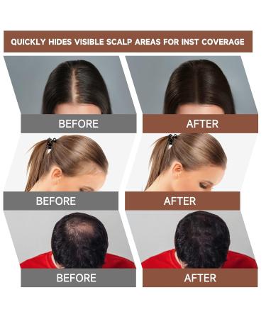 Root Coverage Powder for Thinning Hair - Medium Brown Hair Color Grey Concealer Beard & Eyebrow Touch Up - Buy Online on SooperMarket.com