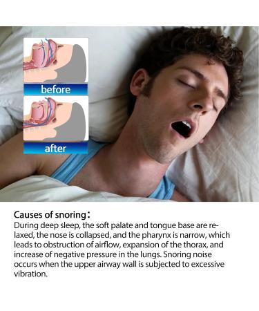 100 Pcs Nasal Strips for Snoring Relief and Nasal Congestion | Colds and Allergies Support - Buy Online on SooperMarket.com