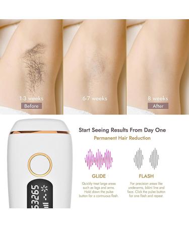 Intelligent IPL Hair Removal Device - Mild Painless & Suitable for Whole Body | Shop Now! - Buy Online on SooperMarket.com