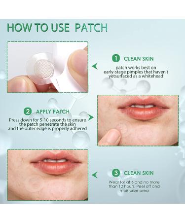 AUSLKA Pimple Patch (9 Patches) - Hydrocolloid Zit Patches for Face - Blemish & Acne Treatment Stickers - Buy Online on SooperMarket.com