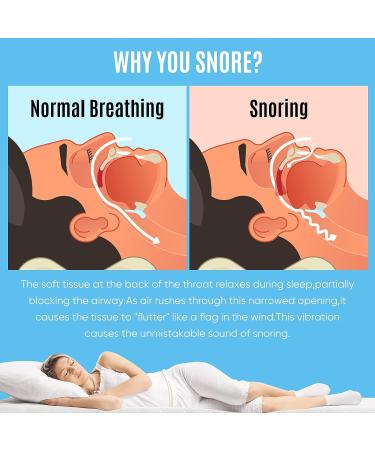 Adjustable Anti-Snoring Mouthpiece for Men and Women - Reusable Snoring Solution for Better Sleep - 1 PCS - Buy Online on SooperMarket.com