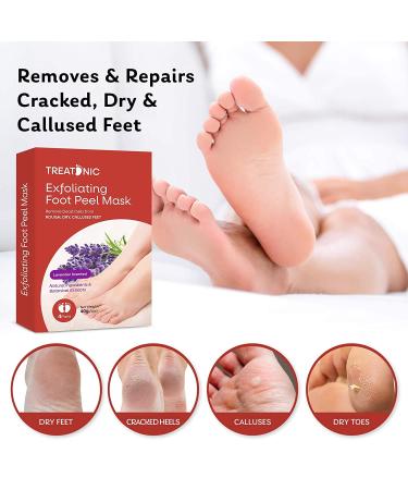 Treatonic Foot Peel Mask - 4 Pairs for Soft Skin, Exfoliates Calluses & Dead Skin - Lavender, Men & Women - Buy Online on SooperMarket.com