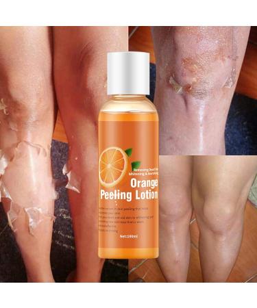 Korean Orange Peel Lotion- Whitening Peel Gel Dead Skin Remover Exfoliator (1 Bottle) - Buy Online on SooperMarket.com