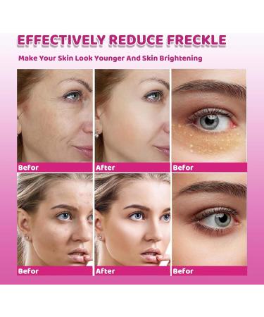 Fade Spots Night Cream Whitening & Lighten Spots & Nourishing Anti-Aging Face Moisturiser Face Care Brightening Face Cream For Firming Hydrating Correct Dark Spots & Acne -Deep Moisturiser Face. - Buy Online on SooperMarket.com