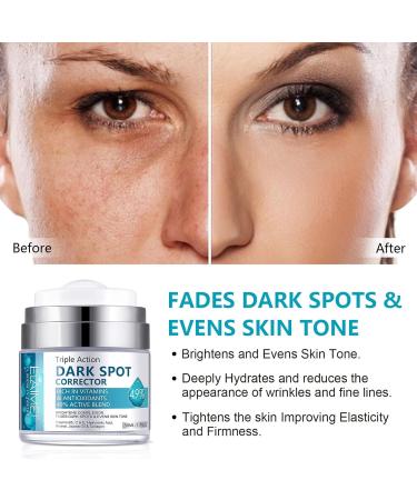 Dark Spot Remover for Face & Body Dark Spot Remover Dark Spot Corrector Cream Hyperpigmentation Treatment Freckle Removel Cream Spot Cream for All Skin Types 50 ml /1.7 fl oz - Buy Online on SooperMarket.com
