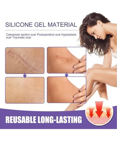 Caesarean Scar Removal Strips - Safe & Effective Scar Gel Tape for Repeated Use - Buy Online on SooperMarket.com
