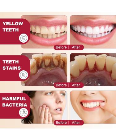 SP-6 Probiotics Ultra Whitening Toothpaste - Deep Cleaning & Fresh Breath 2PCS - Brighten Teeth & Remove Stains - Buy Online on SooperMarket.com