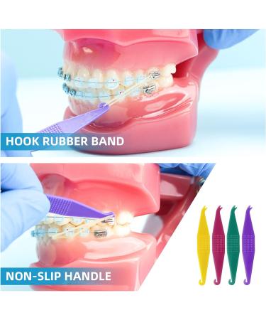 500pc Annhua Dental Orthodontic Rubber Bands | Teeth Gap & Crooked Teeth Braces | Monkey 4.5oz 3/8 - Buy Online on SooperMarket.com