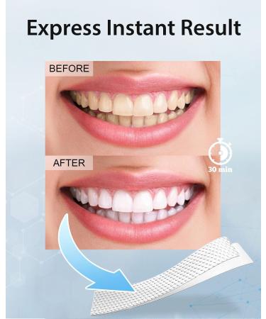 MySmile Teeth Whitening Strips - Non-Sensitive Kit, 28 Sets for 10 Shades Whiter, Removes Stains from Coffee, Wine & More - Buy Online on SooperMarket.com