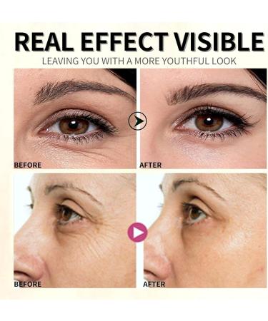 TBeautfave Under Eye Cream for Dark Circles and Puffy Eyes Firming Eye Cream for Wrinkles Eye Bags Remover Day & Night Eye Cream Anti Aging Eye Serum Skincare for Women & Men - Buy Online on SooperMarket.com