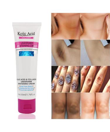 Kojic Acid Skin Whitening Cream for Intimate Areas | Dark Spot Corrector & Bleaching Cream for Body Underarms Knees Elbows | 1.7oz Collagen Milk Formula - Buy Online on SooperMarket.com