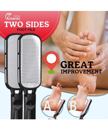 Foot File Callus Remover | Double Sided Scrubber for Dead Skin | Pedicure Tool for Hard Skin, Callus, Plantar Wart, Corn | Skin-Friendly Metal Foot File - Buy Online on SooperMarket.com
