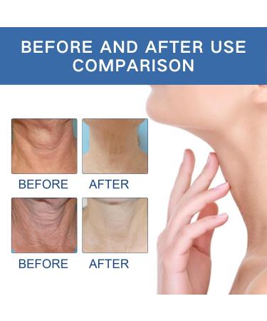 Neck Firming Serum Rapid Lift Advanced Neck Serum Neck Firming Cream Black Neck Remover Neck Lift Skin Tightening for Fine Lines and Wrinkles on the Neck Repair Sagging Skin - Buy Online on SooperMarket.com
