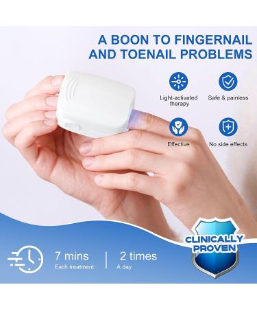Nail Fungus Laser Treatment Device - Home Use Onychomycosis & Fungus Cleaning Treatment for Fingernails & Toenails - 910nm Infrared & 470nm Blue Light - Buy Online on SooperMarket.com